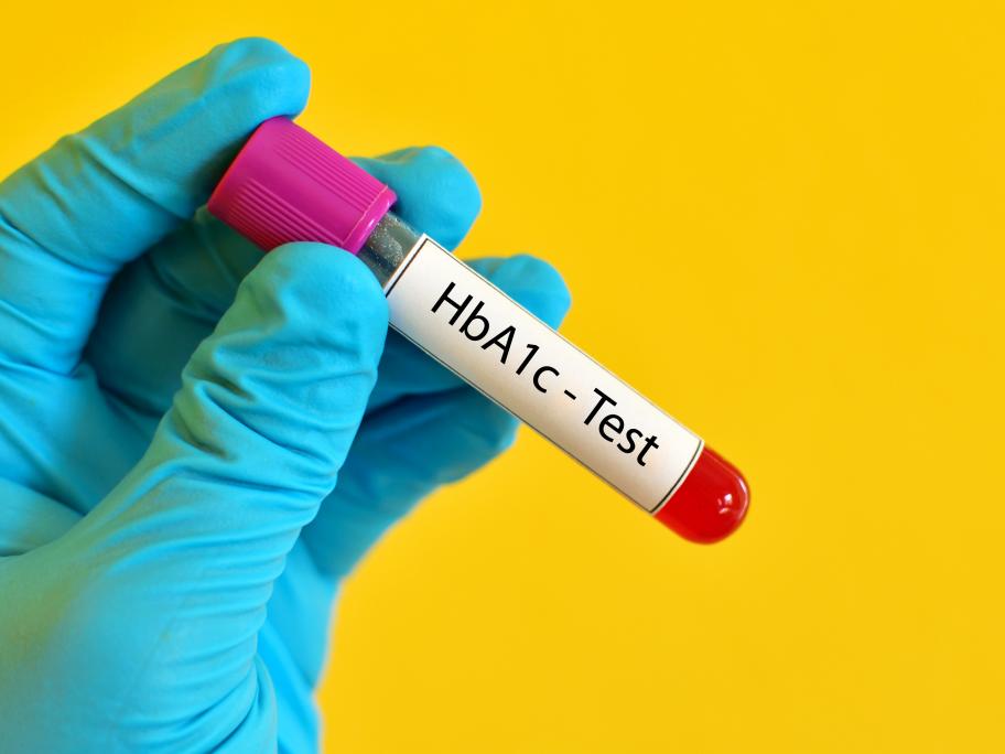 Test tube with blood for HbA1c test