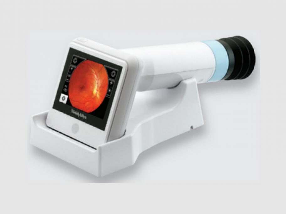 Welch Allyn RetinaVue 100 Imager
