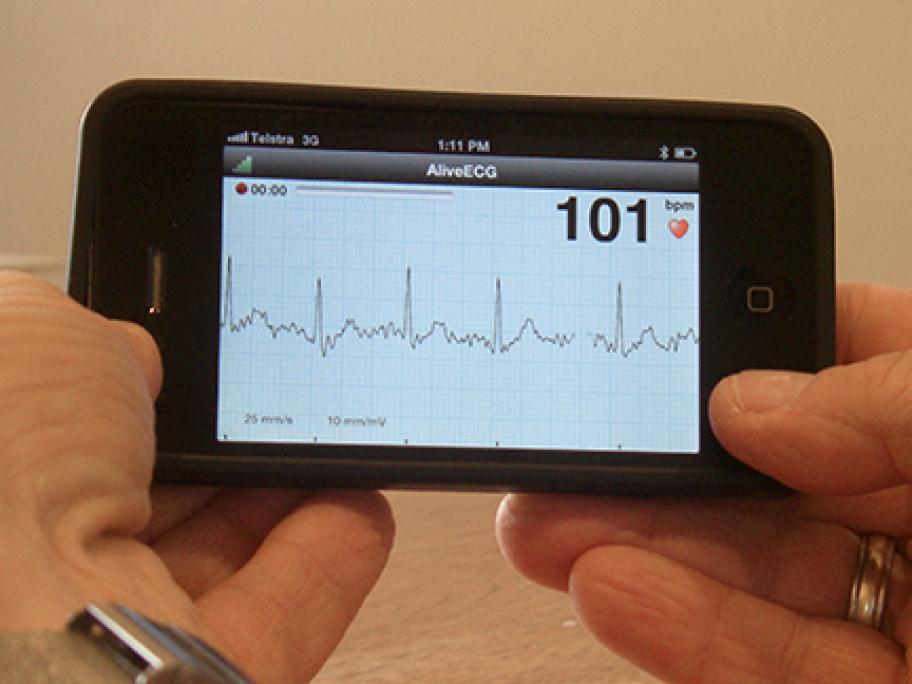 ECG on iPhone